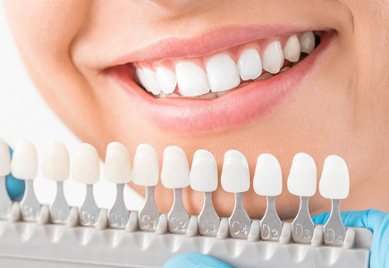 Предварительная проверка перед отбеливанием зубов